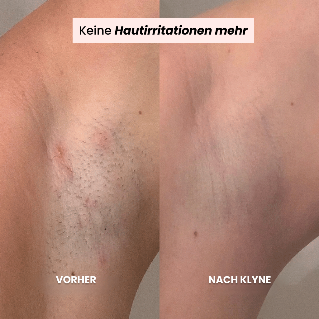 KLYNE® Rasierer